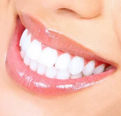 Smile Image