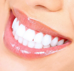 Smile Image